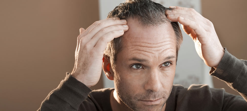 castor oil to regrow receding hairline